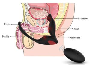 Estimulador de Próstata Recarregável- Langer-RTC - S-Hande - Sexshop