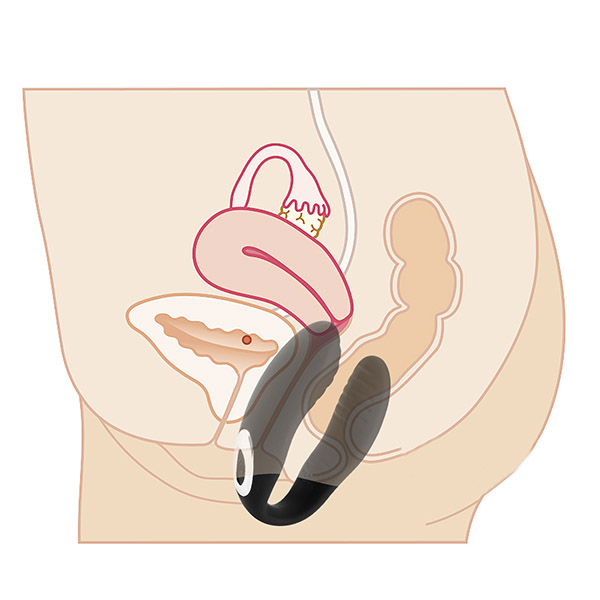 Vibrador para casais U-vibrator NANA - Silicone e Recarregável - Sex shop