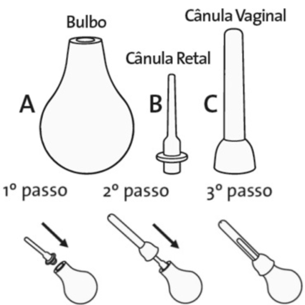 Ducha Xuca Chuca Unissex Higiênica Íntima Anal Vaginal 300ml - Image 2